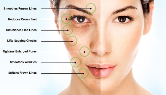 لوسیون بدن پودر هیالورونیک اسید Cas 9067-32-7 مواد اولیه آرایشی
